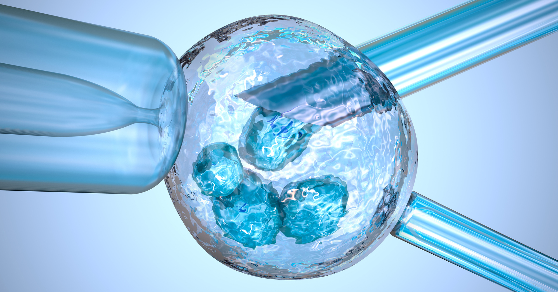 Preimplantasyon Genetik Tanı